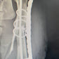 Traumatología