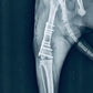 Traumatología